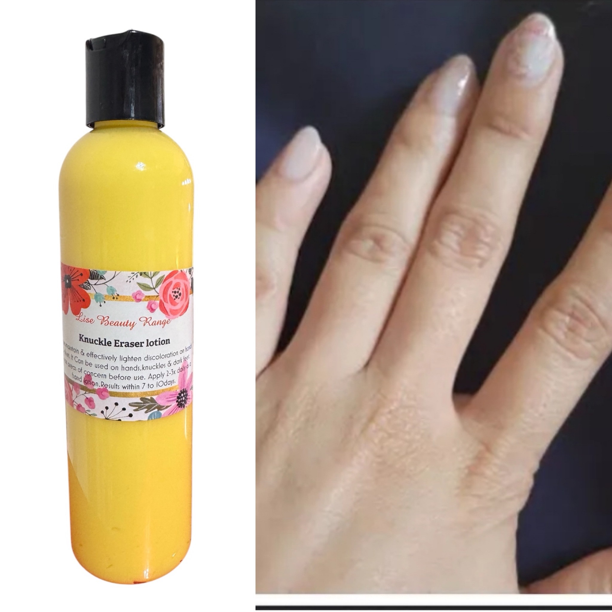 Lise Knuckle Eraser lotion