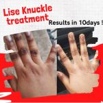 Lise Knuckle Eraser lotion - Image 3