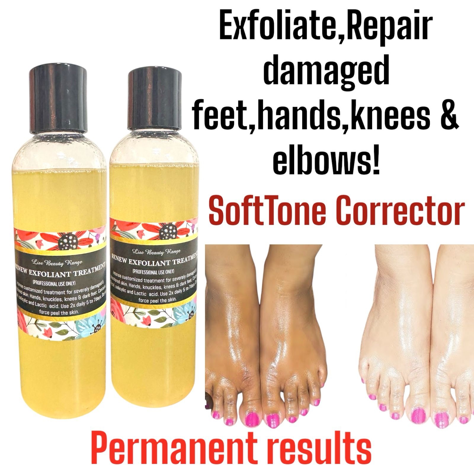 Lise SoftTone Correcting oil